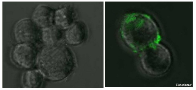 Immunofluorescence analysis of 293T cells by overexpressed SARS-CoV Spike Protein (Right) or not (Left) using SARS-CoV Spike Monoclonal Antibody at dilution of 1:50.