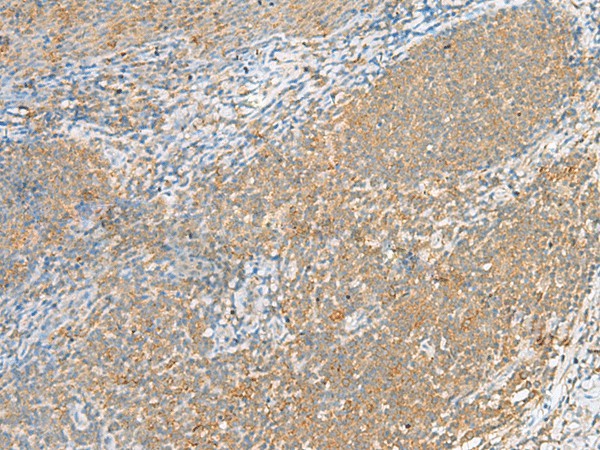 Immunohistochemistry of paraffin-embedded Human tonsil tissue  using FOLR1 Polyclonal Antibody at dilution of 1:80(?200)