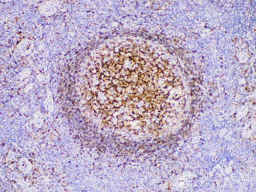 Immunohistochemistry of paraffinembedded Human tonsil tissue with CD74 Monoclonal Antibody(Antigen repaired by EDTA).