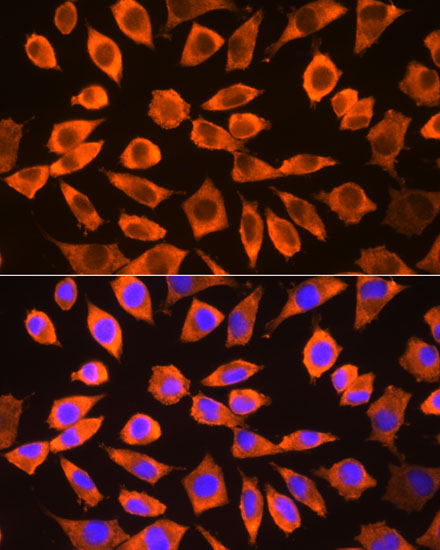 Immunofluorescence analysis of L929 cells using RPS3 Polyclonal Antibody at dilution of 1:100. Blue: DAPI for nuclear staining.