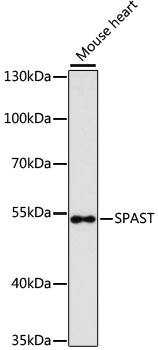 Western blot analysis of extracts of Mouse heart using SPAST Polyclonal Antibody at dilution of 1:3000.