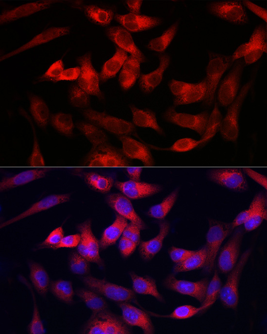 Immunofluorescence analysis of RD cells using Collagen III alpha 1/COL3A1 Polyclonal Antibody at dilution of 1:100. Blue: DAPI for nuclear staining.