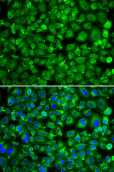 Immunofluorescence analysis of A-549 cells using SAT2 Polyclonal Antibody Blue: DAPI for nuclear staining.