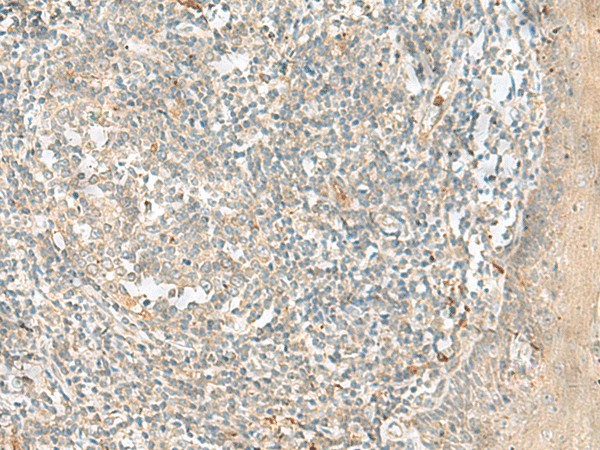 Immunohistochemistry of paraffin-embedded Human tonsil tissue  using TTLL1 Polyclonal Antibody at dilution of 1:90(?200)