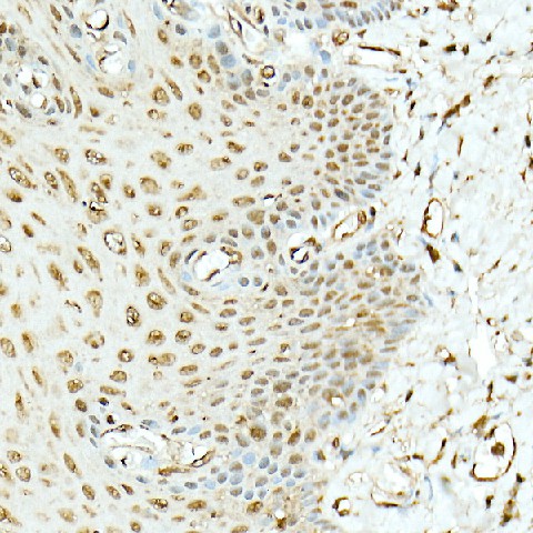 Immunohistochemistry of paraffin-embedded human esophagus using Hsp90β Polyclonal Antibody at dilution of 1:20 (40x lens).Perform high pressure antigen retrieval with 10 mM citrate buffer pH 6.0 before commencing with IHC staining protocol.