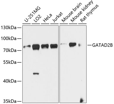 Western blot analysis of extracts of various cell lines using GATAD2B Polyclonal Antibody at dilution of 1:1000.