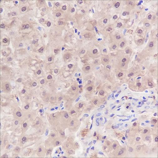 Recombinant SETBP1 Monoclonal Antibody - 3