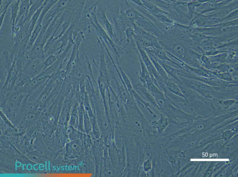 Human Periodontal Ligament Stem Cell Complete Medium - small - 6