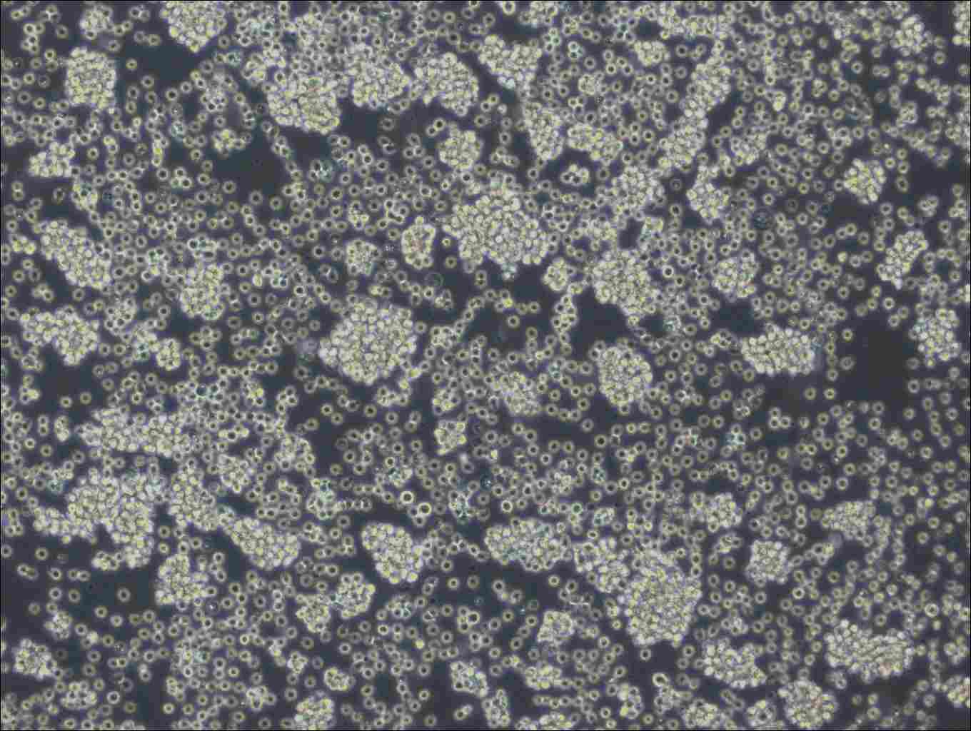 WSU-DLCL2 Cell Complete Medium - 3