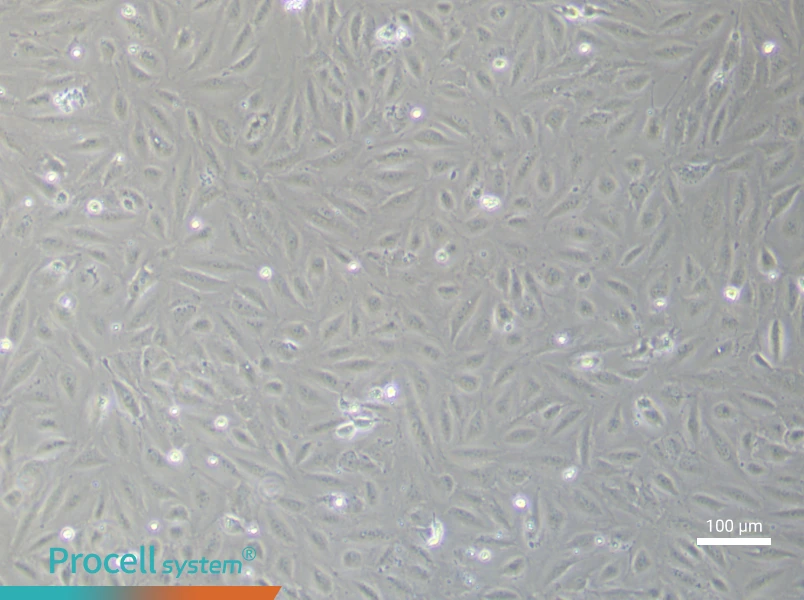 Human Endometrial Epithelial (Primary cell immortalization) Cell Complete MediumHuman Endometrial Epithelial (Primary cell immortalization) Cell Complete Medium - 2