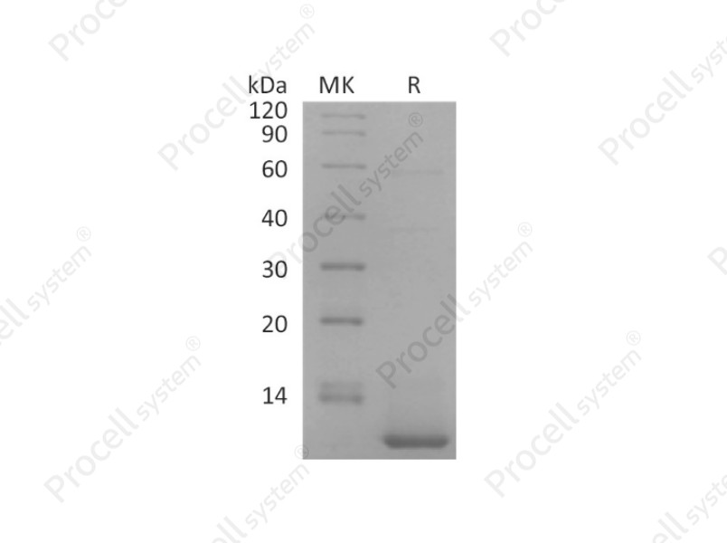 CXCL5/ENA-78, Human, Recombinant