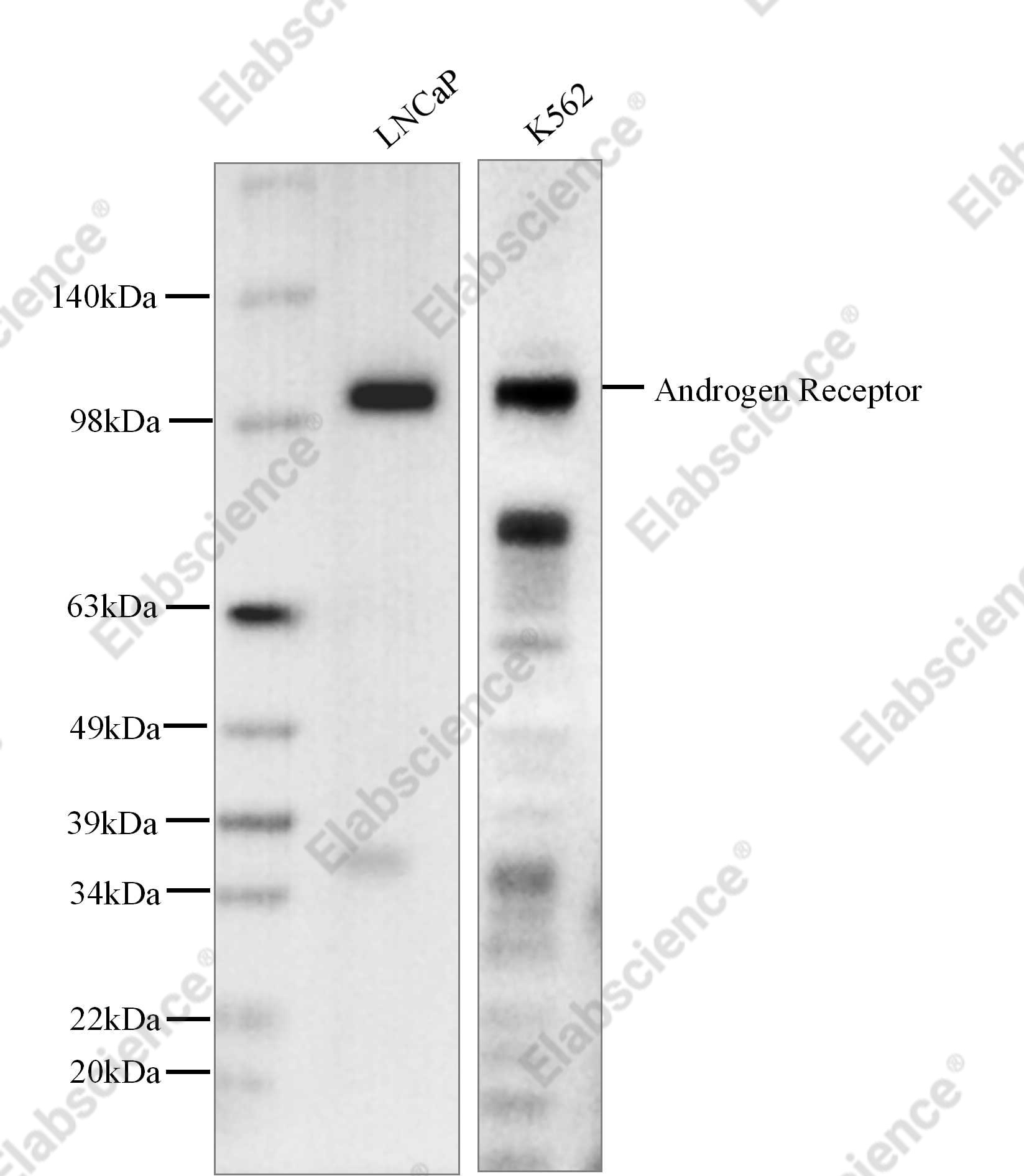 Recombinant Androgen Receptor Monoclonal Antibody - 1
