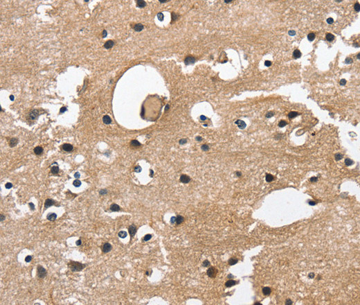 Immunohistochemistry of paraffin-embedded Human brain  tissue using CAMK1D Polyclonal Antibody at dilution 1:50