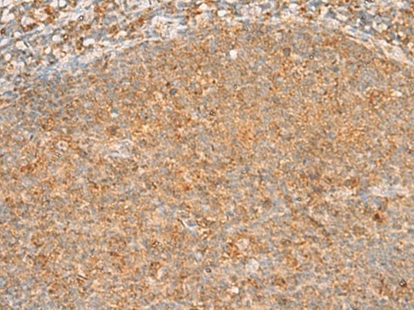 Immunohistochemistry of paraffin-embedded Human tonsil tissue  using PPOX Polyclonal Antibody at dilution of 1:30(?200)