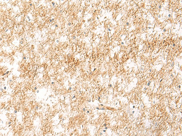 Immunohistochemistry of paraffin-embedded Human brain tissue  using XPC Polyclonal Antibody at dilution of 1:25(?200)