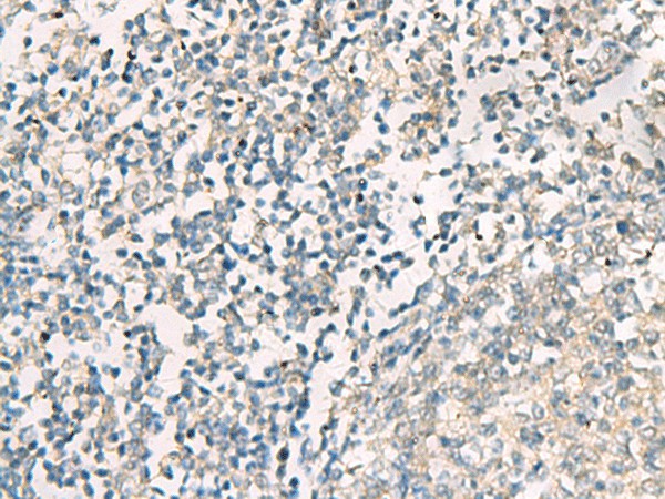 Immunohistochemistry of paraffin-embedded Human tonsil tissue  using SERPINB4 Polyclonal Antibody at dilution of 1:40(?200)