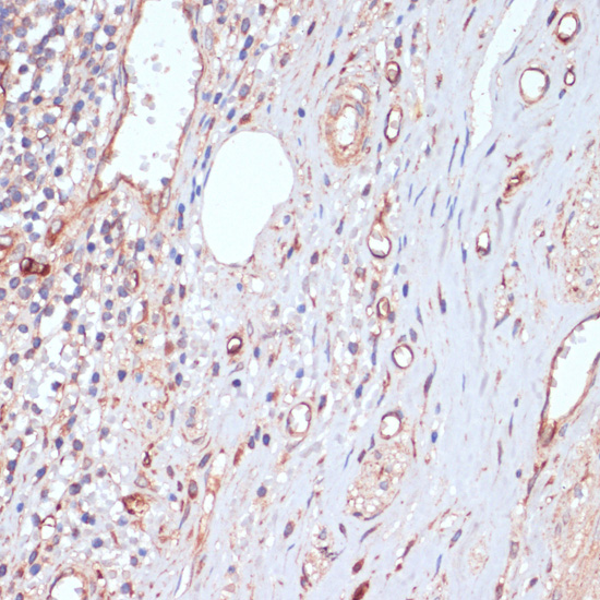 Immunohistochemistry of paraffin-embedded Human appendix using CD34 Polyclonal Antibody at dilution of  1:100 (40x lens).