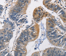 PGK1 Polyclonal Antibody - 3
