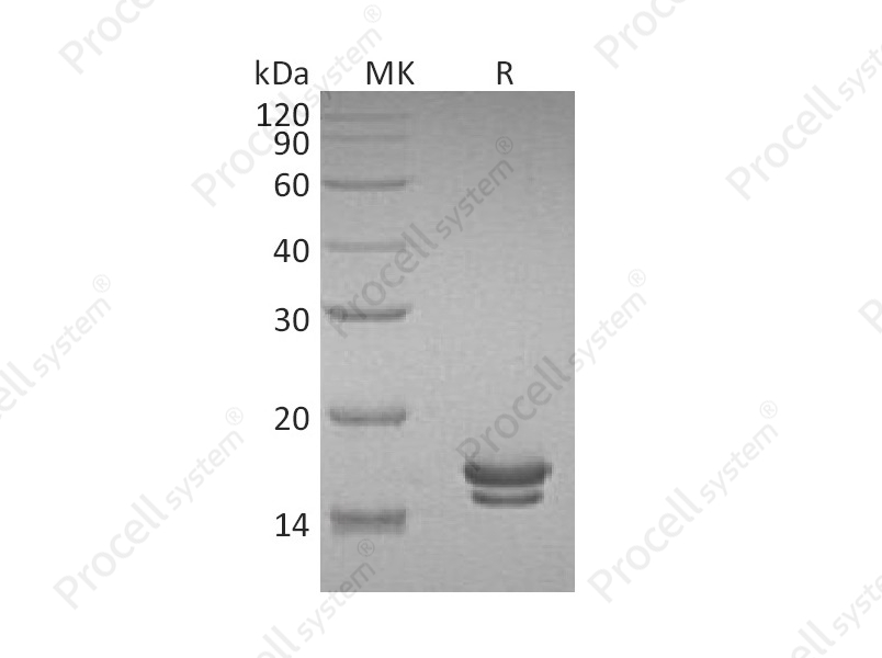 IL-2 (C-6His), Rat, Recombinant