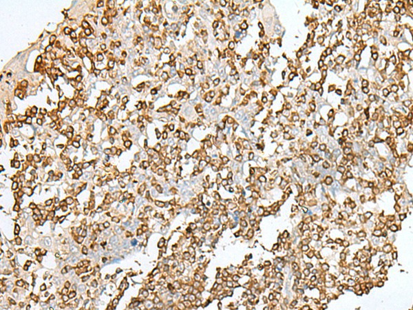 Immunohistochemistry of paraffin-embedded Human tonsil tissue  using SEPT1 Polyclonal Antibody at dilution of 1:50(?200)