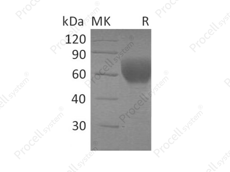 TGF&beta;R2/TGFBR2, Human, Recombinant