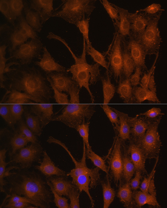 Immunofluorescence analysis of C6 cells using PFKM Polyclonal Antibody at dilution of 1:100 (40x lens). Blue: DAPI for nuclear staining.