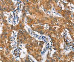 STAT2 Polyclonal Antibody - 2