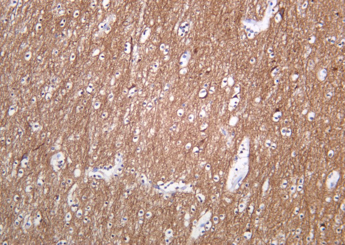 Recombinant Tubulin α (Acetyl Lys40) Monoclonal Antibody - small - 2