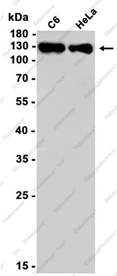 Recombinant Integrin alpha V Monoclonal Antibody - 2