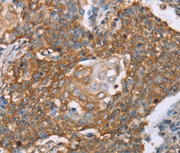 PAICS Polyclonal Antibody - 2
