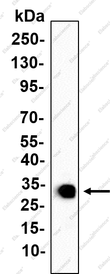 Recombinant CDK5 Monoclonal Antibody - 1