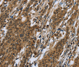 RAP1B Polyclonal Antibody - 3