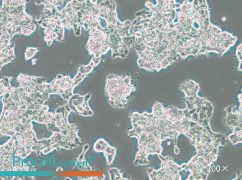 ZR-75-1 Cell Complete Medium - 5