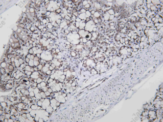 Recombinant OCT1 Monoclonal Antibody - 3