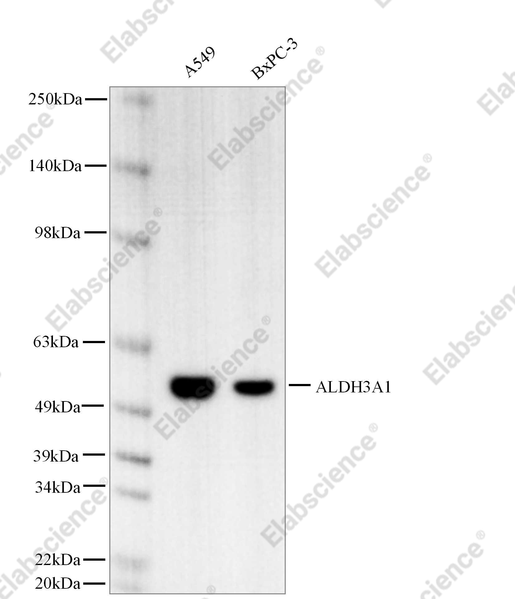 Recombinant ALDH3A1 Monoclonal Antibody - 1