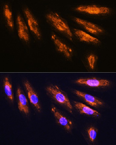 Immunofluorescence analysis of H9C2 cells using NMDAR2A Polyclonal Antibody at dilution of 1:100. Blue: DAPI for nuclear staining.