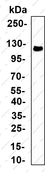 Recombinant BCL11A Monoclonal Antibody - 1