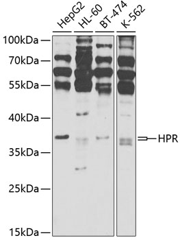 Western blot analysis of extracts of various cell lines using HPR Polyclonal Antibody at 1:1000 dilution.