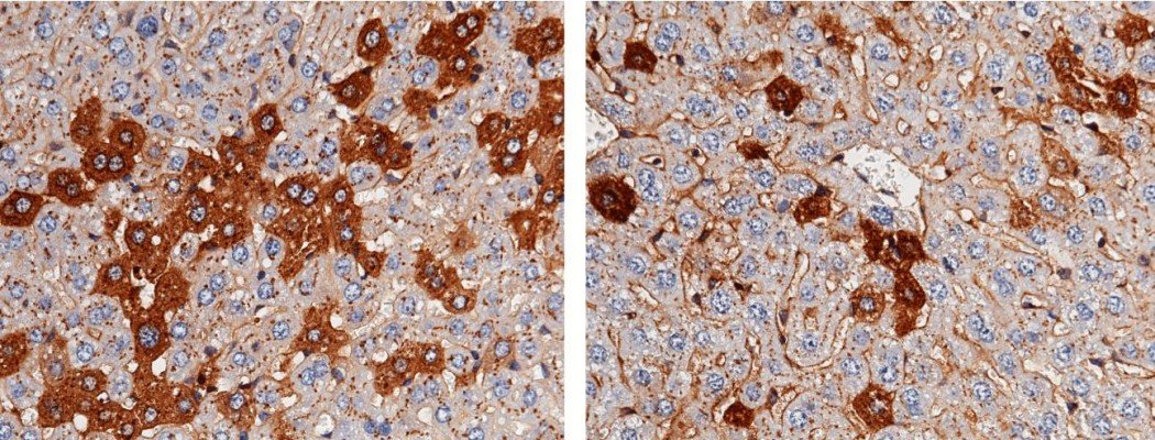 Recombinant Fetuin-A/AHSG Monoclonal Antibody-searchlist-1