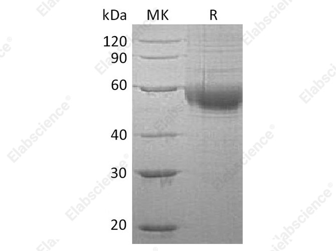 Recombinant Human PLA2G7/Lp-PLA2 Protein (His Tag) - 1