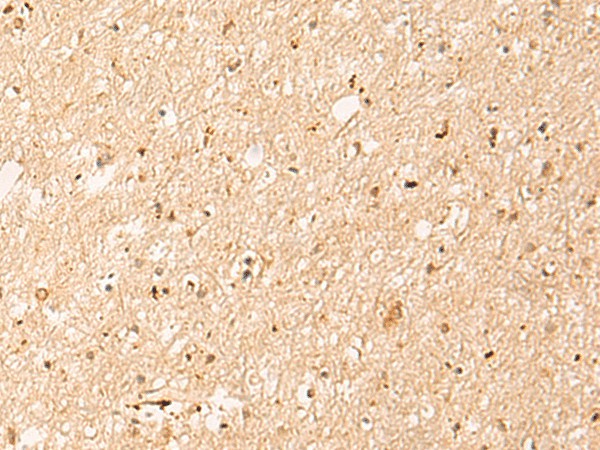 Immunohistochemistry of paraffin-embedded Human brain tissue  using IL1RAPL2 Polyclonal Antibody at dilution of 1:25(?200)