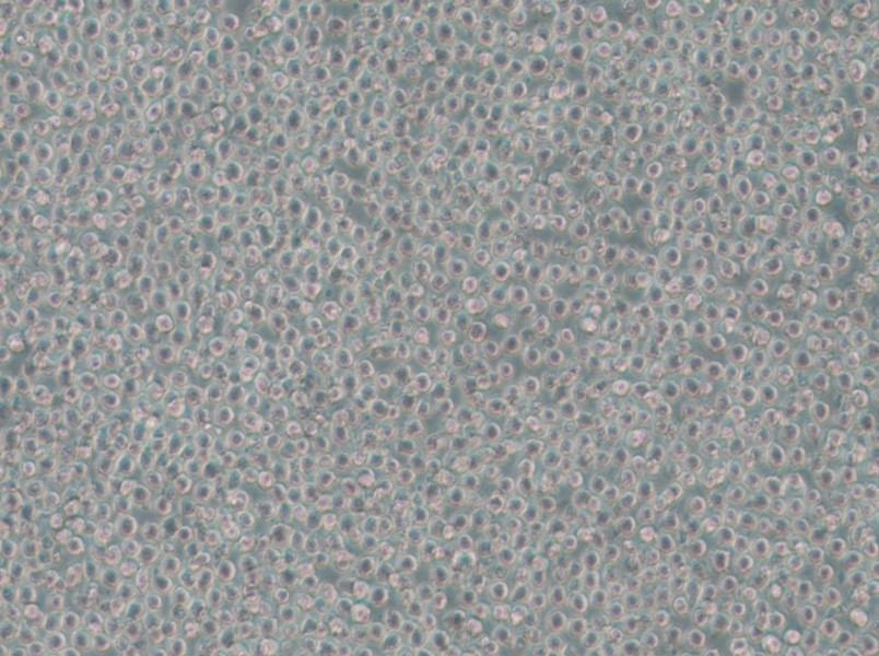 OCI-AML-3 Cell Complete Medium - small - 5