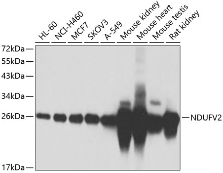 Western blot analysis of extracts of various cell lines using NDUFV2 Polyclonal Antibody at 1:1000 dilution.