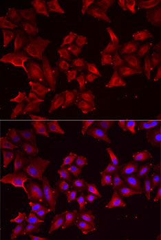 Immunofluorescence analysis of MCF7 cells using PCBD1 Polyclonal Antibody