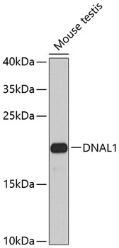 Western blot analysis of extracts of mouse testis using DNAL1 Polyclonal Antibody at 1:1000 dilution.