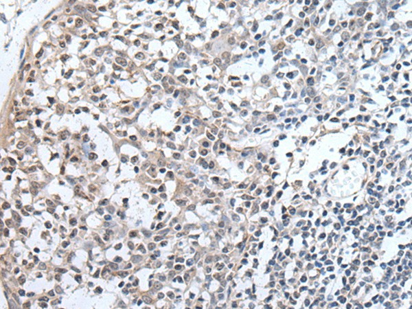 Immunohistochemistry of paraffin-embedded Human tonsil tissue  using PLAG1 Polyclonal Antibody at dilution of 1:25(?200)