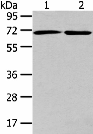 Western Blot analysis of A431 and hela cell using ARFGAP2 Polyclonal Antibody at dilution of 1/200