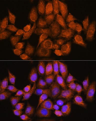 Immunofluorescence analysis of HeLa cells using ARHGAP30 Polyclonal Antibody at dilution of 1:100. Blue: DAPI for nuclear staining.