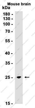 Recombinant HPRT Monoclonal Antibody - 1
