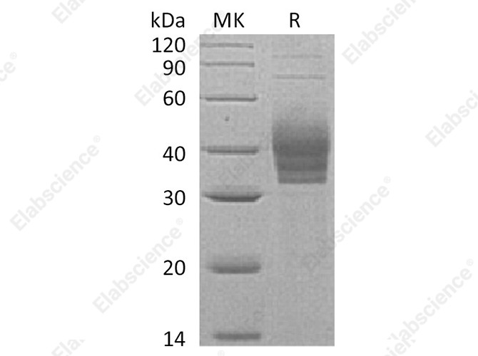 Recombinant Human CLEC4E/Mincel Protein (His Tag) - 1
